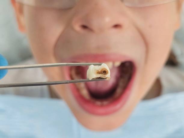 Best Weekend Emergency Dentist in Lakeland, MN